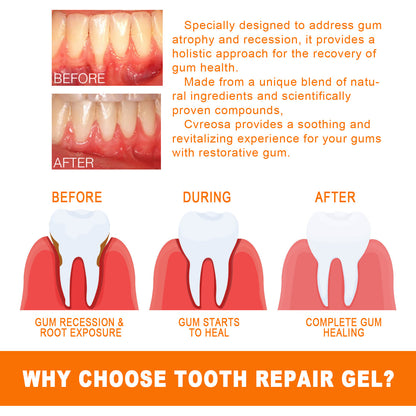 EELHOE Teeth Repair Essence Deep Cleans Yellow Teeth, Tooth Stains, Tartar, and Gum Care Oral Care Essence